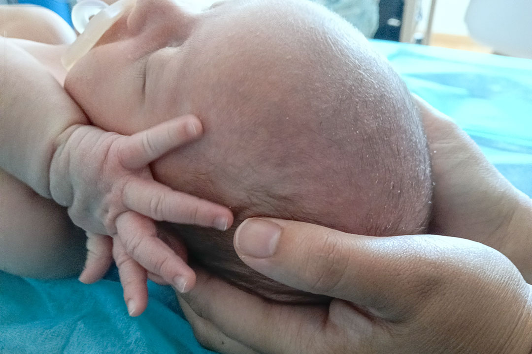 Fisioterapia pediátrica en Idun