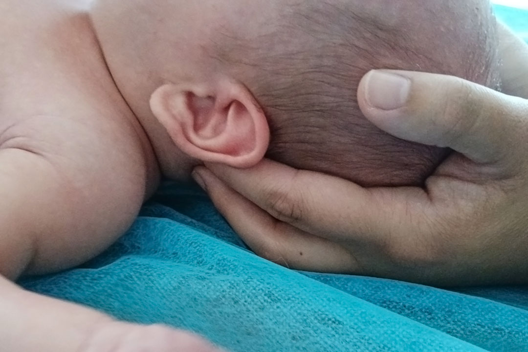 Fisioterapia pediátrica en Idun